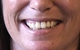 femalesmile1